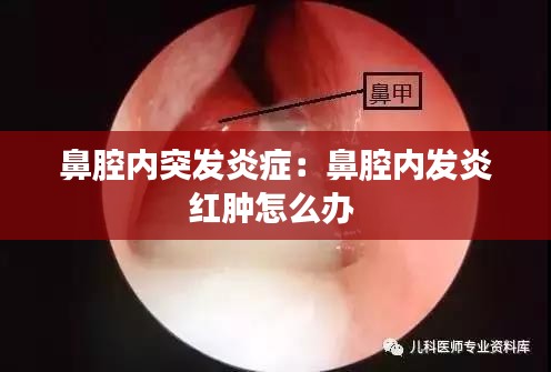 鼻腔內(nèi)突發(fā)炎癥：鼻腔內(nèi)發(fā)炎紅腫怎么辦 