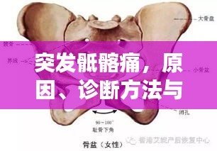 突發(fā)骶髂痛，原因、診斷方法與治療策略
