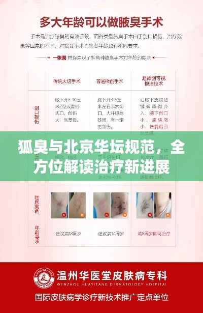 狐臭與北京華壇規(guī)范，全方位解讀治療新進展