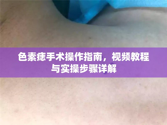 色素痣手術(shù)操作指南，視頻教程與實(shí)操步驟詳解