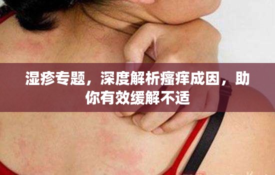 濕疹專題，深度解析瘙癢成因，助你有效緩解不適