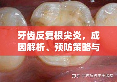 牙齒反復(fù)根尖炎，成因解析、預(yù)防策略與治療方法